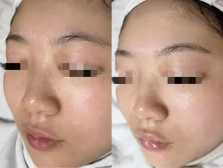 MONICAビューティサロン所属・MONICAサロン ⭐︎フェイシャル痩身のエステ・リラクイメージ