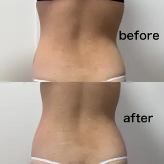 Miiju.所属・Miiju. 石巻市 脂肪冷却  鈴木のエステ・リラクイメージ