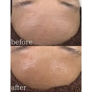 BIREINA Eyelash  Salon所属・BIREINA 住之江公園のマツエク・マツパデザイン