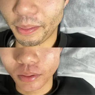 脱毛サロンMIRUDA所属・脱毛サロン MIRUDAのエステ・リラクイメージ