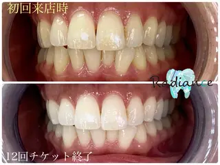 札幌ホワイトニング ラディアンス札幌駅店のその他イメージ