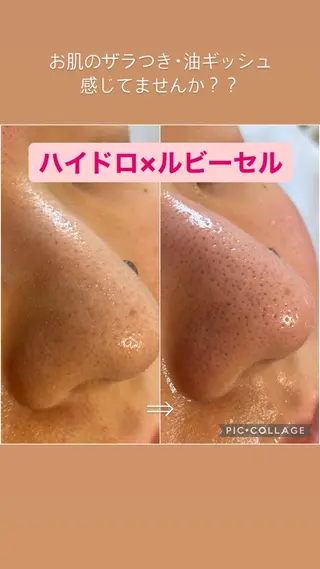 毛穴レス ハーブ＆ ワックス脱毛×光脱毛のエステ・リラクイメージ