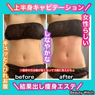 痩身/脱毛/ネイル HARUKAのエステ・リラクイメージ