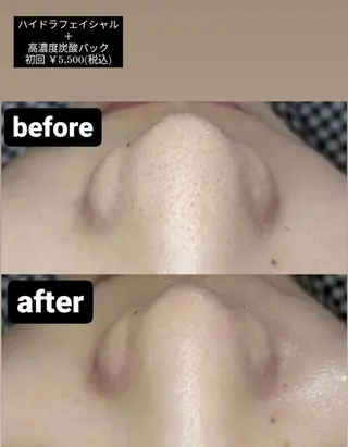 emirai 🌙AYANOのエステ・リラクイメージ