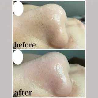 韓国肌管理 【毛穴専科】のエステ・リラクイメージ