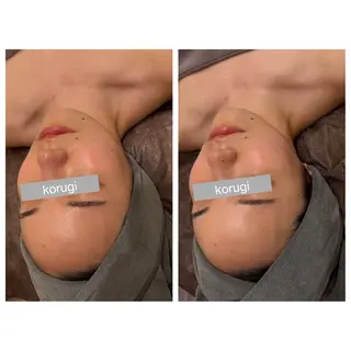 ☆痩身/小顔☆ ハイパーナイフexのエステ・リラクイメージ