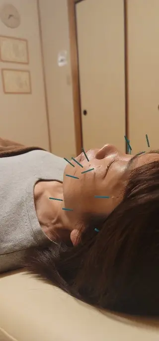 なかむら鍼灸院所属・なかむら 鍼灸院のエステ・リラクイメージ