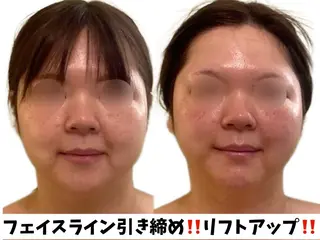 サロンハート浦和店所属・痩身小顔サロンハート 浦和店のエステ・リラクイメージ