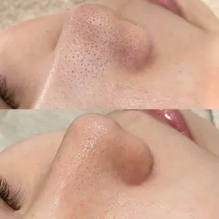 beautysalon RAVIS所属・東大阪/韓国肌管理/ 痩身バスト専門店のエステ・リラクイメージ