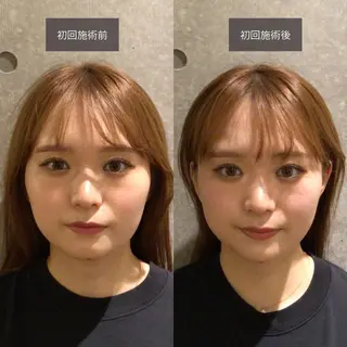 小顔矯正/姿勢矯正 美容整体師　野口杏太のエステ・リラクイメージ