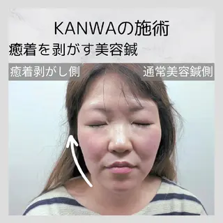 KANWA鍼灸院所属・KANWA 鍼灸院のエステ・リラクイメージ
