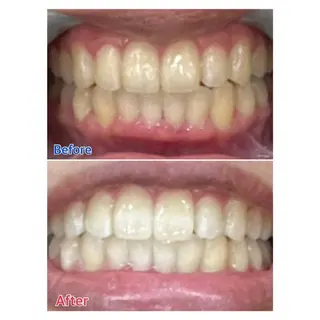 MBEAUTYSALON 千葉店・京成大久保所属・Melty 輝のその他イメージ