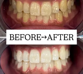 【歯科提携】歯のセルフホワイトニング専門店 セルフホワイトニングサロン宝塚所属・箕浦 乙葉のその他イメージ