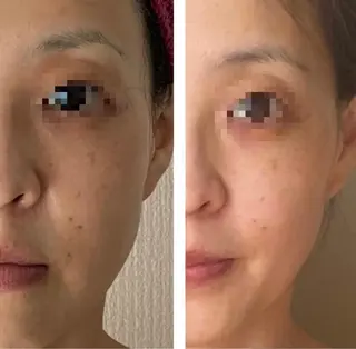 糸島 エステサロンmiuのエステ・リラクイメージ