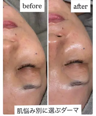 Salon【yuzu.】所属・🍊肌管理×美眉 【yuzu.】の眉毛・アイブロウイメージ