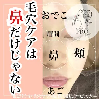 メンズ epismoo 脱毛/HBL/毛穴の眉毛・アイブロウイメージ