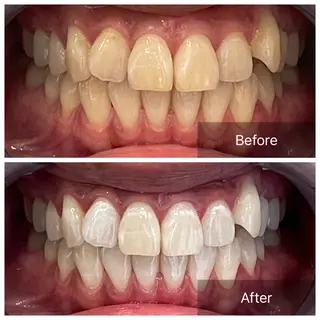 ホワイトニングサロンライエ所属・岡本 由香理のその他イメージ