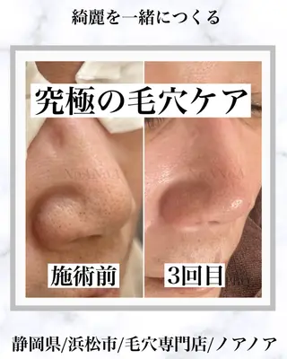 NoANoA Naguraの眉毛・アイブロウイメージ