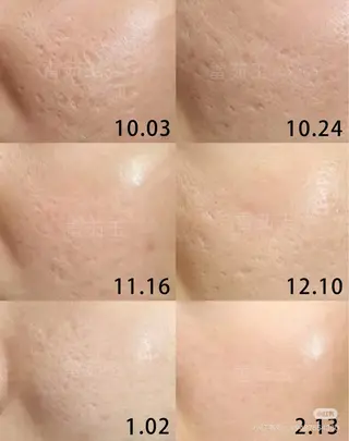 ショート 愛維美水光美肌専門店所属・愛維美水光美肌専門店 メンズレディースokのエステ・リラクイメージ