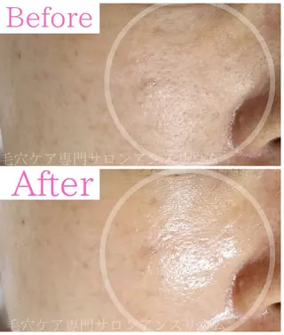 毛穴ケア専門サロンアンスリウム所属・茨城土浦 つくば毛穴 ケア専門サロンのエステ・リラクイメージ