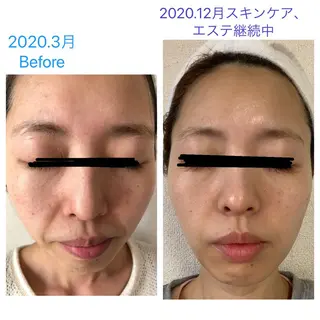 💆‍♀️松田 亜沙美のエステ・リラクイメージ