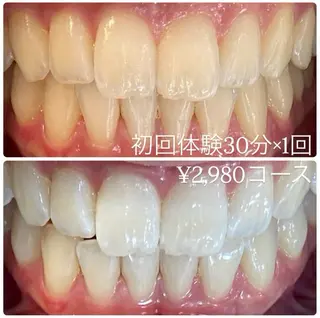 メンズ ホワイトニングルーム　川崎店所属・ホワイトニング ルーム　川崎店のその他イメージ