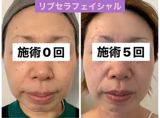 Private Salon Prunelle所属・プライベートサロン プリュネルのエステ・リラクイメージ