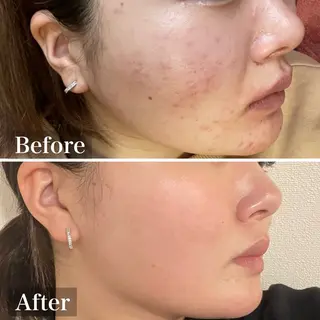 中尾 朱里のエステ・リラクイメージ