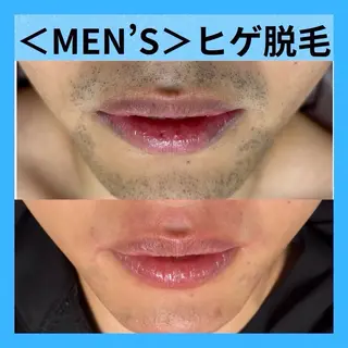 メンズ メディカルエステ マドンナ富士宮店のエステ・リラクイメージ