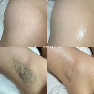 HOTEL&PARK Mikuワックス脱毛のエステ・リラクイメージ