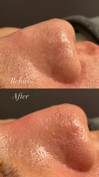 Lilyboo 多田のエステ・リラクイメージ