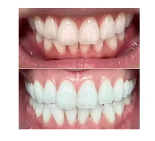 ホワイトニングジム 池袋のその他イメージ