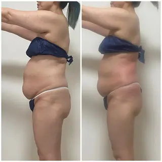 セルライトクラッシュ 腸もみ bi♡eruのその他イメージ