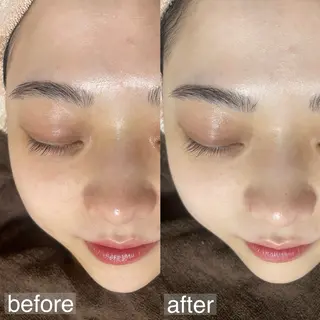 アイブロウ&フェイシャルサロンa‘lm所属・WAX脱毛/肌質改善 眉毛とお肌のサロンのエステ・リラクイメージ