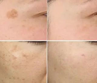 全身脱毛＆VIO脱毛 紹介率№1♪リナ♪のエステ・リラクイメージ