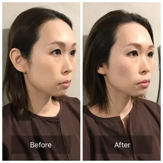 新宿hari-me所属・美容鍼hari-me 新宿のエステ・リラクイメージ