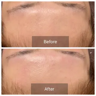 産毛専門店 Bittoのエステ・リラクイメージ