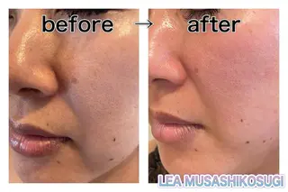 LEA MUSASHIKOSUGI所属・美肌育成サロン LEA武蔵小杉のエステ・リラクイメージ