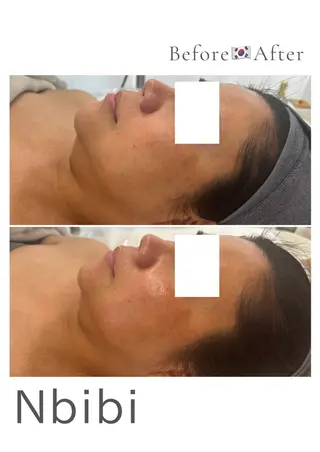 韓国🇰🇷価格 サロン_Nbibiのエステ・リラクイメージ