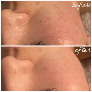 メンズ メナード岐阜市茜部 杉浦のエステ・リラクイメージ