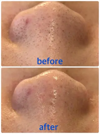 mana 東梅田店のエステ・リラクイメージ