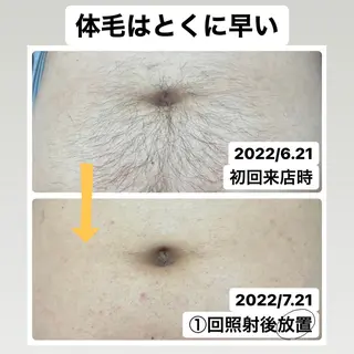 メンズ メンズ脱毛サロン Le falcoのエステ・リラクイメージ