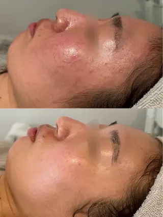 小顔×痩身専門サロンCLORE浦和店所属・石川 彩花のエステ・リラクイメージ