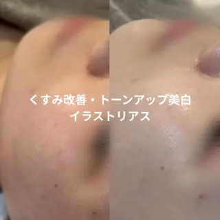 【LEPUS】レプス nishimoriのエステ・リラクイメージ