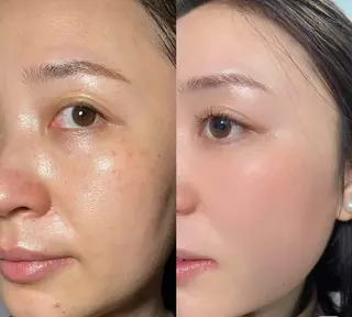 マツエク・マツパ aliaハイフ&水光ジェットサロン所属・aliaハーブ水光店 エステティシャン募集のエステ・リラクイメージ