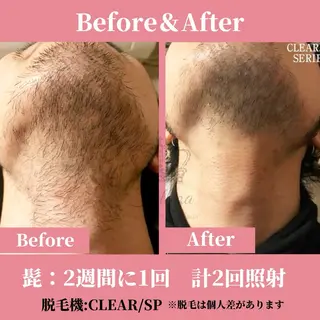 メンズ 有人型セルフサロン 脱毛/痩身/美顔のその他イメージ