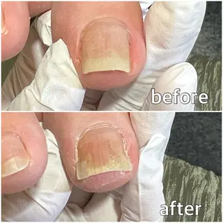 ネイル 巻き爪補正店 堺東店のネイルデザイン