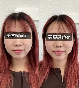 hari salon de off 美容鍼灸×小顔整体【ハリサロンドオフ】所属・美容鍼灸×小顔整体♡ ハリサロンドオフ堺東のエステ・リラクイメージ