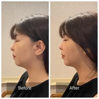 美容鍼　蒼月-aotsuki-所属・美容鍼「蒼月」 -アオツキ-のエステ・リラクイメージ