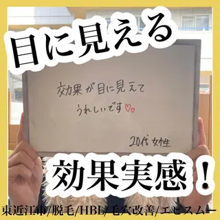 epismoo 脱毛/HBL/毛穴の眉毛・アイブロウイメージ